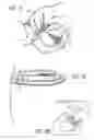 Fig. 16 - Snapping and hinging arrangements, watches and associated methods