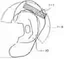 Fig. 01 - Acoustic vibration generating element