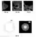 Fig. 05 - Method and system for detecting a fiducial in digital projection images