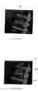 Fig. 08 - Methods and systems for combining a plurality of radiographic images