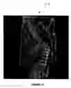 Fig. 09 - Methods and systems for combining a plurality of radiographic images