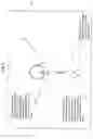 Fig. 02 - Lens defect correction