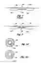 Fig. 02 - Methods and apparatuses for bonding in athermal optical fiber packages