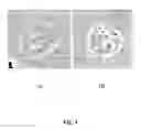 Fig. 02 - Process for the manufacturing of human mononuclear phagocytic leukocytes