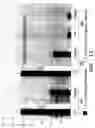Fig. 16 - Isolated lineage negative hematopoietic stem cells and methods of treatment therewith