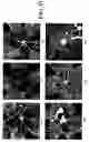 Fig. 28 - Isolated lineage negative hematopoietic stem cells and methods of treatment therewith