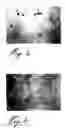 Fig. 02 - Compositions comprising preconditioned myoblasts having enhanced fusion properties