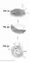 Fig. 04 - Methods, instruments and materials for chondrocyte cell transplantation
