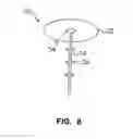 Fig. 08 - Methods, instruments and materials for chondrocyte cell transplantation