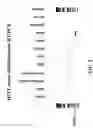 Fig. 19 - Human testis expressed patched like protein