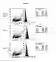 Fig. 11 - Use of NOTCH pathway interfering agents for treatment of plasma cell disorders