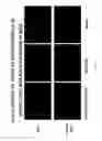 Fig. 40 - Cancer treatment methods using selected immunoconjugates for binding to aminophospholipids