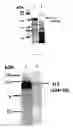 Fig. 02 - Tick chitinase