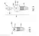 Fig. 06 - Screw device for orthodontic treatment