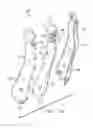 Fig. 02 - Prophylactic systems for dental instruments and methods for using the same