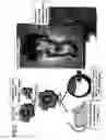 Fig. 07 - Method of screening reprogramming factor, reprogramming factor screened by the method, method of using the reprogramming factor, method of differentiating undifferentiated fused cells and method of constructing cell, tissues and organs