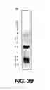 Fig. 07 - Cloning, sequencing and expression of a gene encoding an eukaryotic amino acid racemase, and diagnostic, therapeutic, and vaccination applications of parasite and viral mitogens