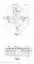 Fig. 02 - Variable valve apparatus and methods