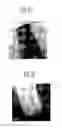 Fig. 08 - Method of forming isolation film in semiconductor device
