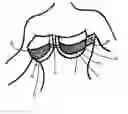 Fig. 01 - Support bra