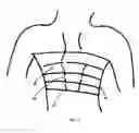 Fig. 06 - Support bra