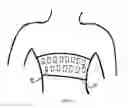 Fig. 07 - Support bra