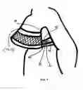 Fig. 08 - Support bra