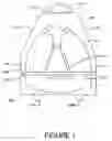 Fig. 02 - Transportable trampoline system