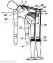 Fig. 01 - Lift assist device and method