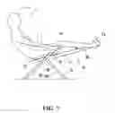 Fig. 08 - Abdominal exerciser