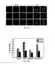 Fig. 03 - Methods for identifying modulators of intracellular aggregate formation