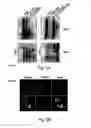 Fig. 04 - Methods for identifying modulators of intracellular aggregate formation