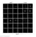 Fig. 08 - Methods for identifying modulators of intracellular aggregate formation