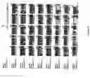 Fig. 08 - Nucleic acid coding for the cgl1 polypeptide and diagnostic and therapeutic application of said nucleic acid and of the cgl1 polypeptide