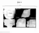 Fig. 08 - Method and compositions for inhibiting tumorigenesis