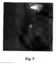 Fig. 06 - Method for improving treatment selectivity and efficacy using intravascular photodynamic therapy