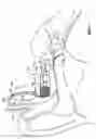 Fig. 02 - Electrophysiological measurement method and system for positioning an implantable, hearing instrument transducer