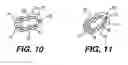 Fig. 06 - Heart wall tension reduction apparatus and method