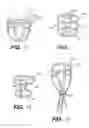 Fig. 07 - Heart wall tension reduction apparatus and method