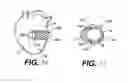 Fig. 08 - Heart wall tension reduction apparatus and method