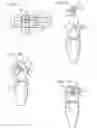 Fig. 04 - Method and system for positioning a medical device at one or more angles relative to an imaging probe