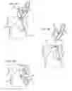 Fig. 05 - Method and system for positioning a medical device at one or more angles relative to an imaging probe