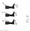 Fig. 08 - Sensor prosthetic for improved balance control