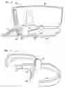 Fig. 03 - Knee-ankle-foot positioning kit