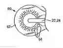 Fig. 01 - Dressing and an epidermal positioning mechanism and method for using same