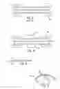 Fig. 02 - Dressing and an epidermal positioning mechanism and method for using same