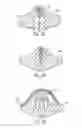 Fig. 11 - Dressing and an epidermal positioning mechanism and method for using same