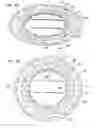 Fig. 35 - Dressing and an epidermal positioning mechanism and method for using same