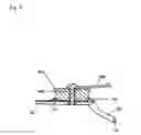 Fig. 07 - Wrist support apparatus for bowling