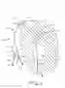 Fig. 02 - Dialysis catheter